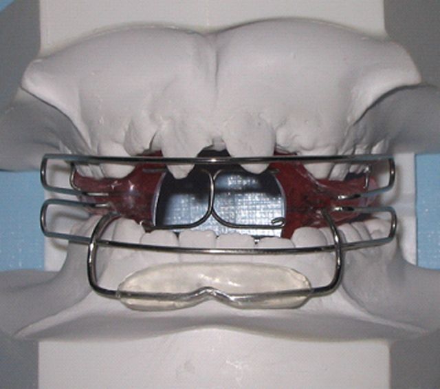  Centro dental Ortodoncia Mar De Grado activador 2